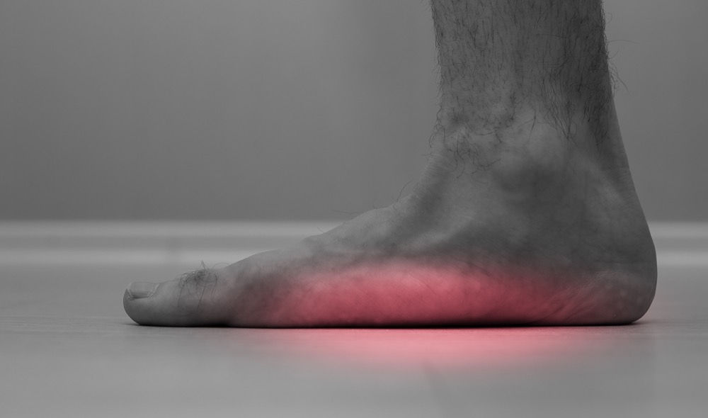 Custom orthotics